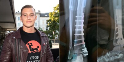 Ranet og skadet: - Skar seg totalt